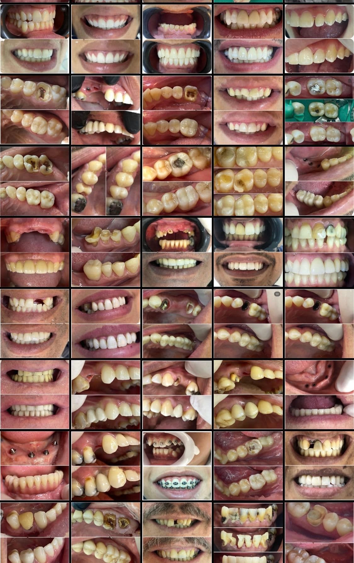 FOTOS DE ANTES x DEPOIS DENTISTA