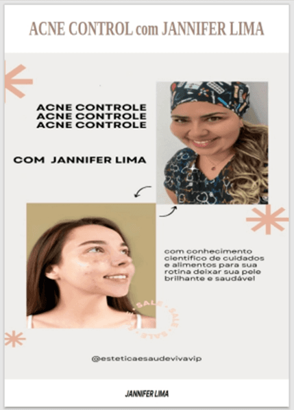 ACNE CONTROL com JANNIFER LIMA