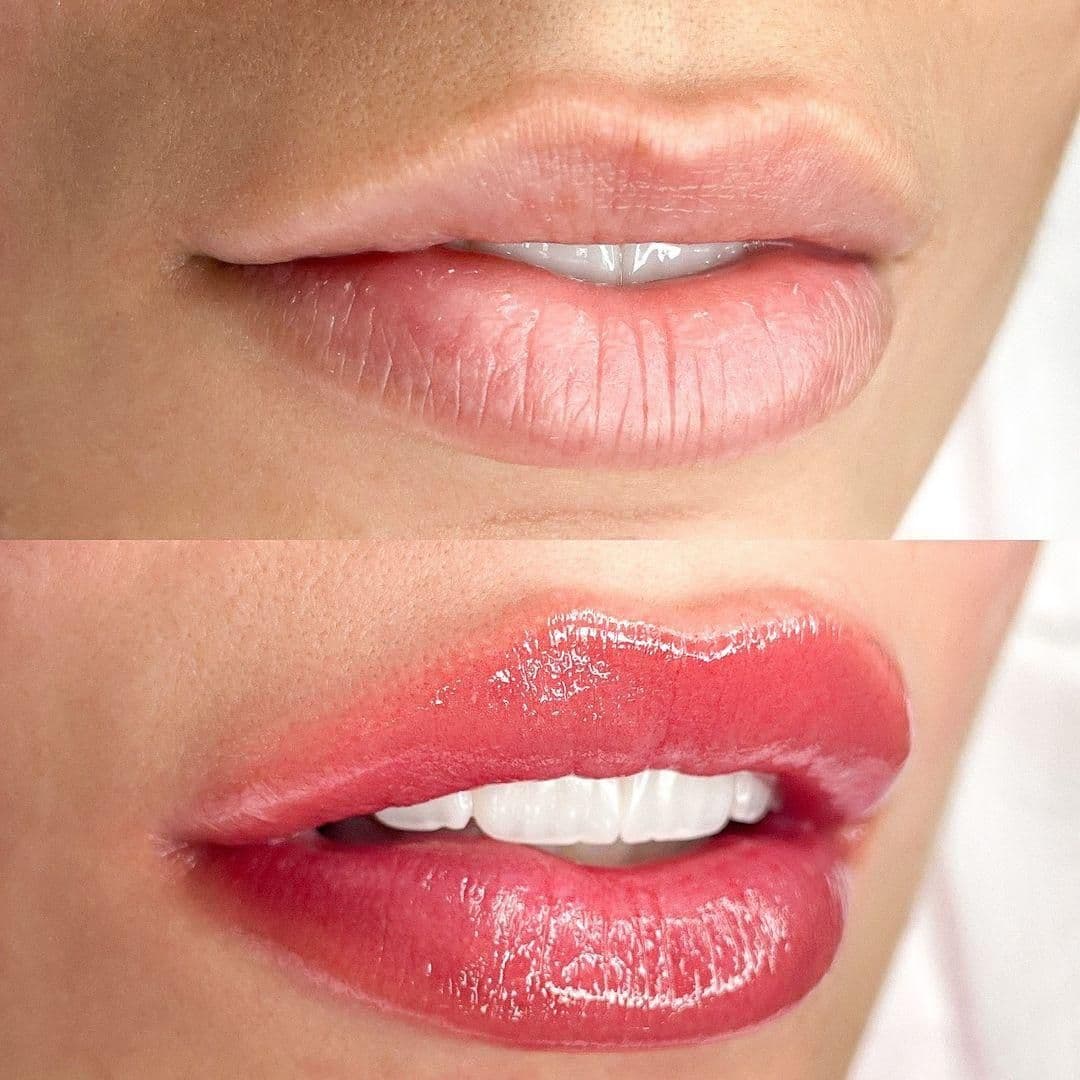 Curso de Nanopigmentação Labial: Domine a Técnica e Inicie uma Nova Carreira