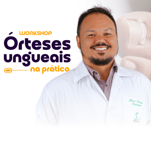 Workshop Órteses Ungueais na Prática