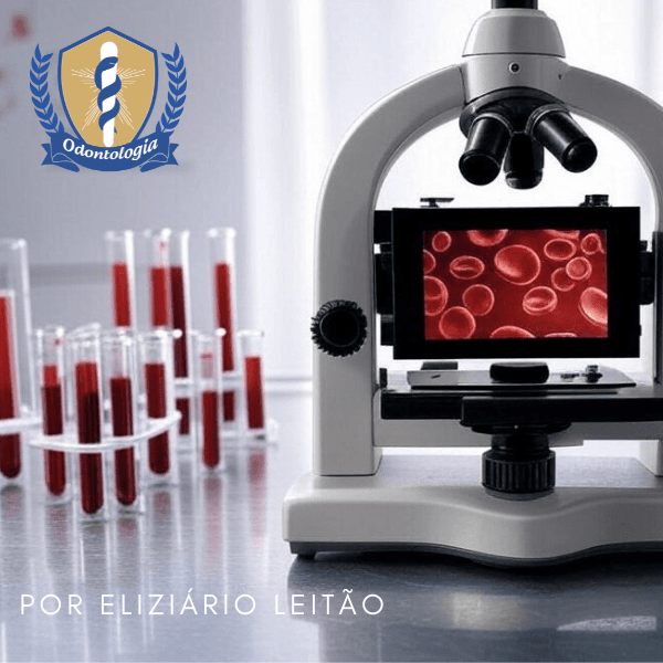 CURSO INTERPRETAÇÃO DE EXAMES HEMATOLÓGICOS EM ODONTOLOGIA - HEMOGRAMA COMPLETO, COAGULOGRAMA,SOROLOGIA E EXAMES BIOQUÍMICOS.