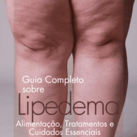 Guia Completo Sobre Lipedema - Alimentação, Tratamentos e Cuidados Essenciais