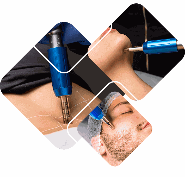 Curso Aplicação de Enzimas sem Agulhas