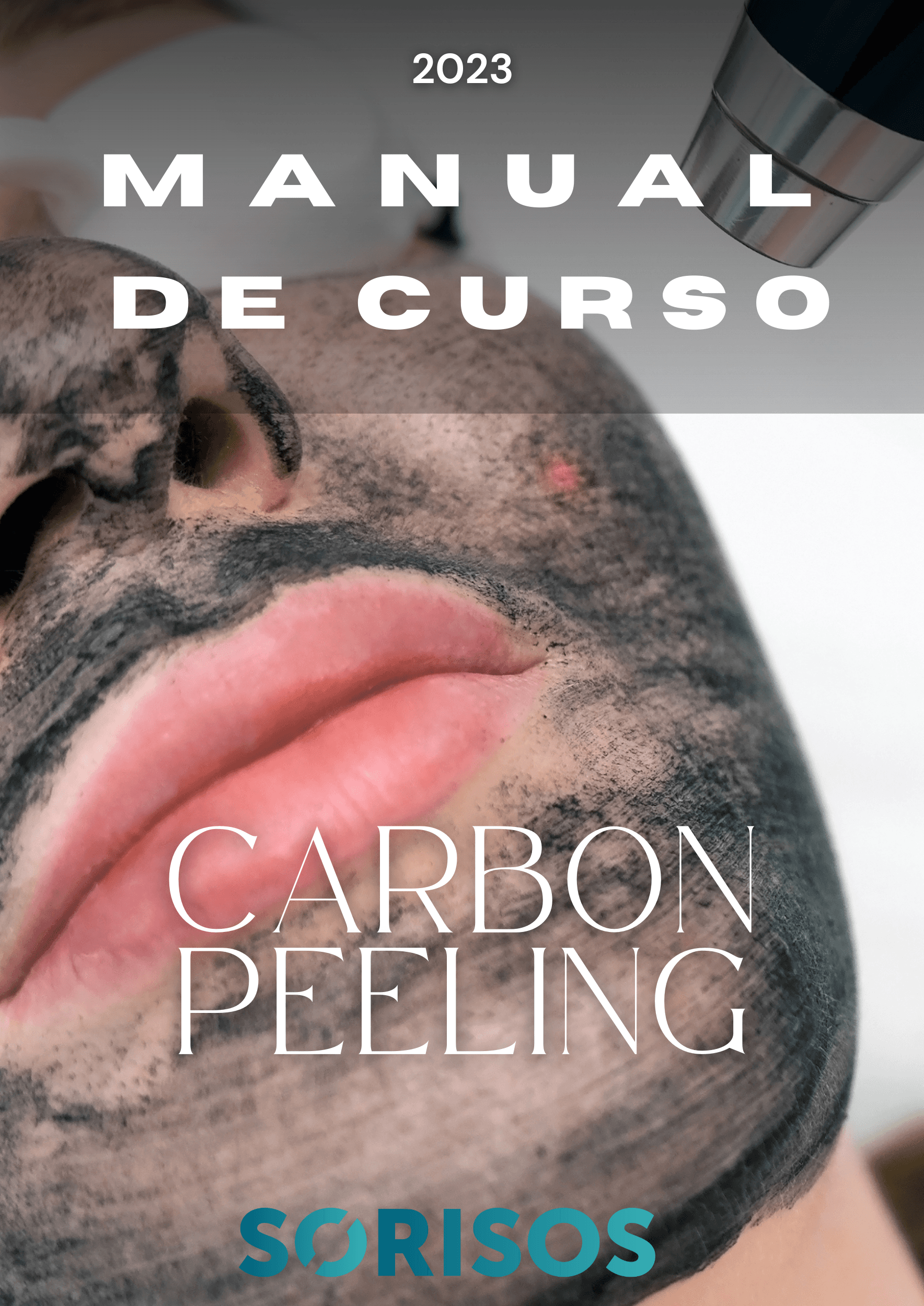 CARBON PEELING A LASER ( PEELING A LASER COM PASTA DE CARVÃO) - MANUAL DE CURSO