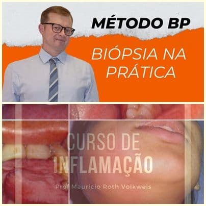 Especial para Dentistas - Domine Biópsias e Inflamação