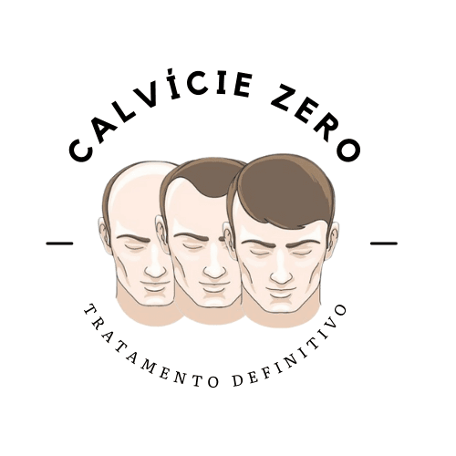 Calvície Zero